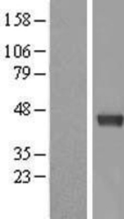 Novus Biologicals&trade;&nbsp;Dnmt3L Overexpression Lysate