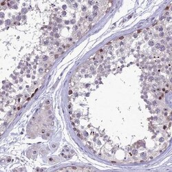 DNTTIP2 Antibody, Novus Biologicals 25 &mu;L | Buy Online | Novus Biologicals | Fisher Scientific