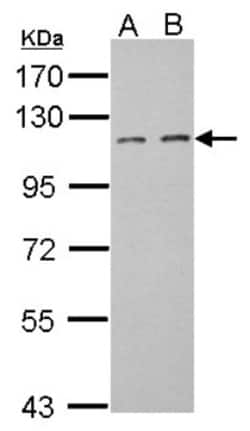 DOC1 Antibody, Novus Biologicals 0.1mL; Unlabeled:Antibodies, Polyclonal