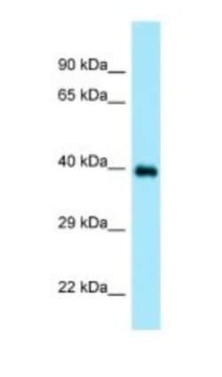Doc2-alpha Antibody, Novus Biologicals 100&mu;L; Unlabeled:Antibodies,