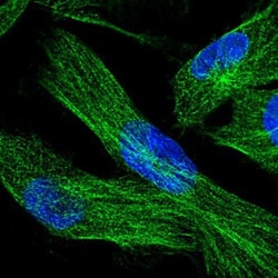 DOC2B Antibody, Novus Biologicals 25ul | Buy Online | Novus Biologicals | Fisher Scientific