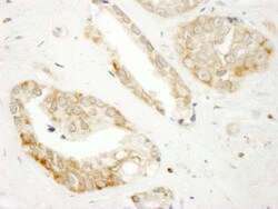 DOCK4 Antibody, Novus Biologicals 0.1mL; Unlabeled:Antibodies, Polyclonal