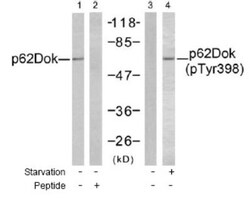 DOK1, p Tyr398 Antibody, Novus Biologicals 0.025 mL | Buy Online | Novus Biologicals | Fisher Scientific