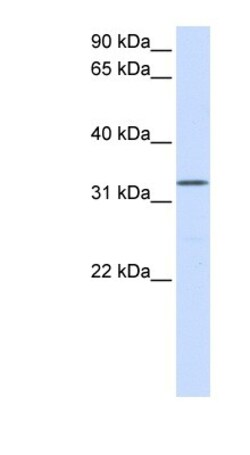 DOK5 Antibody, Novus Biologicals 100&mu;L; Unlabeled:Antibodies, Polyclonal