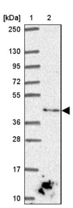 DOK5 Antibody, Novus Biologicals 0.1mL; Unlabeled:Antibodies, Polyclonal