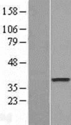 Novus Biologicals&trade;&nbsp;DOK6 Overexpression Lysate