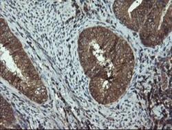 DOK7 Antibody (OTI1A9), Novus Biologicals 0.1mL; Unlabeled:Antibodies,