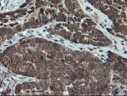 DOK7 Antibody (OTI1A9), Novus Biologicals 0.1mL; Unlabeled:Antibodies,