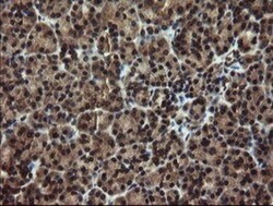 DOK7 Antibody (OTI1A9), Novus Biologicals 0.1mL; Unlabeled:Antibodies,
