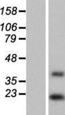 Novus Biologicals&trade;&nbsp;DOLPP1 Overexpression Lysate