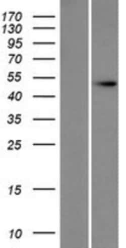 Novus Biologicals&trade;&nbsp;DXO Overexpression Lysate