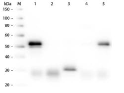 Donkey anti-Rabbit IgG (H+L) Secondary Antibody, Texas Red, Novus Biologicals™