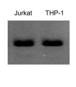 Donkey anti-Rat IgG (H+L) Secondary Antibody, HRP, Novus Biologicals 2mg;