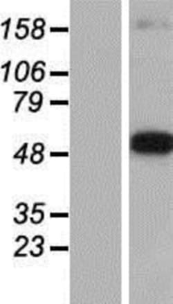Novus Biologicals&trade;&nbsp;Dopa Decarboxylase/DDC Overexpression Lysate