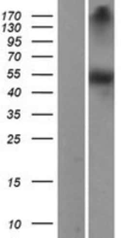 Novus Biologicals&trade;&nbsp;Dopa Decarboxylase/DDC Overexpression Lysate