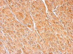 Dopamine beta-Hydroxylase Antibody, Novus Biologicals 0.1mg; Unlabeled:Antibodies,