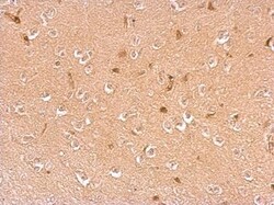 Dopamine beta-Hydroxylase Antibody, Novus Biologicals 0.1mg; Unlabeled:Antibodies,