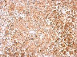 Dopamine beta-Hydroxylase Antibody, Novus Biologicals 0.1mg; Unlabeled:Antibodies,
