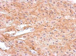 Dopamine D1R/DRD1 Antibody, Novus Biologicals 0.1mL; Unlabeled:Antibodies,
