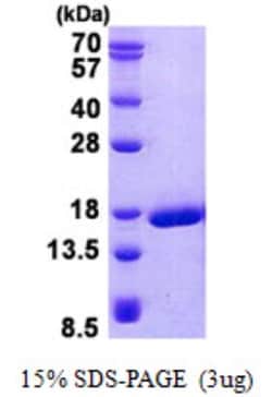 Novus Biologicals&trade;&nbsp;Recombinant Human Doppel His Protein