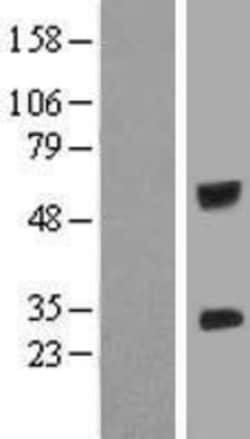 Novus Biologicals&trade;&nbsp;IGSF6/DORA Overexpression Lysate