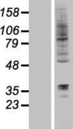Novus Biologicals&trade;&nbsp;DORFIN Overexpression Lysate
