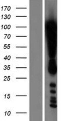 Novus Biologicals&trade;&nbsp;DOT1L Overexpression Lysate