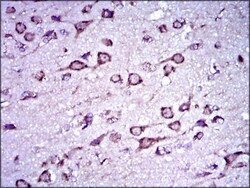 Doublecortin Antibody (2G5) - BSA Free, Novus Biologicals:Antibodies:Primary