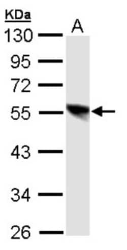DP1 Antibody, Novus Biologicals 0.1mL; Unlabeled:Antibodies, Polyclonal