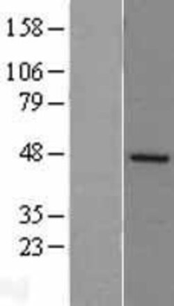 Novus Biologicals™ DP2 Overexpression Lysate