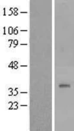 Novus Biologicals&trade;&nbsp;DPAGT1 Overexpression Lysate