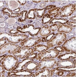 DPAGT1 Antibody, Novus Biologicals 25 &mu;L, Unlabeled:Antibodies, Polyclonal