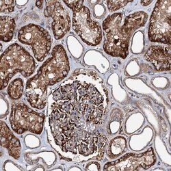MAGEB1 Antibody, Novus Biologicals:Antibodies:Primary Antibodies