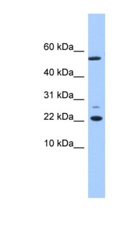 DPH4 Antibody, Novus Biologicals:Antibodies:Primary Antibodies