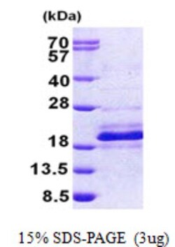 Novus Biologicals&trade;&nbsp;Recombinant Human DPH4 His Protein