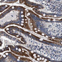 DPH4 Antibody, Novus Biologicals 0.1mL; Unlabeled:Antibodies, Polyclonal