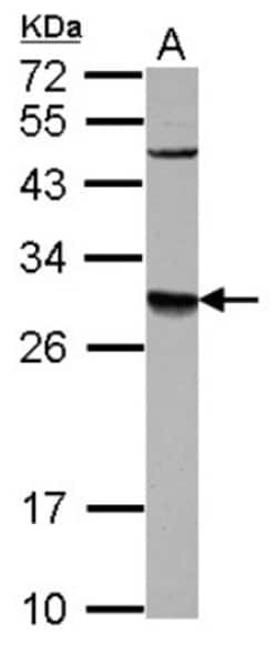 DPM1 Antibody, Novus Biologicals 0.1mL; Unlabeled:Antibodies, Polyclonal