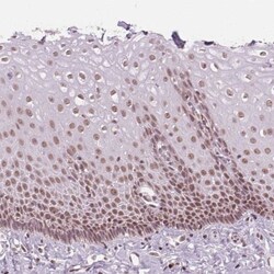 DPM2 Antibody, Novus Biologicals 0.1mL; Unlabeled:Antibodies, Polyclonal