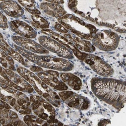 DPM3 Antibody, Novus Biologicals 0.1mL; Unlabeled:Antibodies, Polyclonal