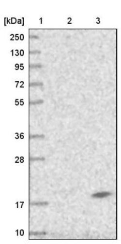 DPM3 Antibody, Novus Biologicals 0.1mL; Unlabeled:Antibodies, Polyclonal