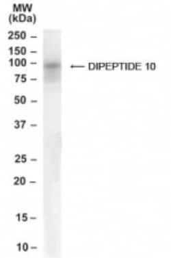 DPP10 Antibody, Novus Biologicals 0.1mg; Unlabeled:Antibodies, Polyclonal