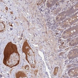 DPP10 Antibody, Novus Biologicals 25 &mu;L, Unlabeled:Antibodies, Polyclonal