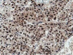 DPP3 Antibody (OTI2D9), Novus Biologicals 0.1mL; Unlabeled:Antibodies,