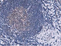 DPP3 Antibody (OTI2D9), Novus Biologicals 0.1mL; Unlabeled:Antibodies,