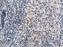 DPP3 Antibody (OTI2D9), Novus Biologicals 0.1mL; Unlabeled:Antibodies,