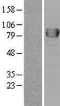 Novus Biologicals&trade;&nbsp;DPP3 Overexpression Lysate