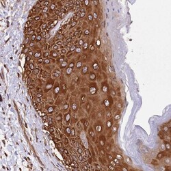 DPP3 Antibody, Novus Biologicals 0.1mL; Unlabeled:Antibodies, Polyclonal