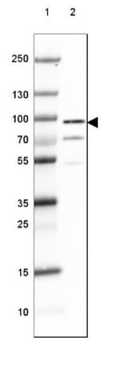DPP6 Antibody, Novus Biologicals 0.1mL; Unlabeled:Antibodies, Polyclonal
