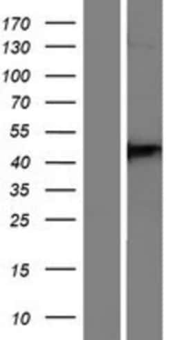 Novus Biologicals™ DPP6 Overexpression Lysate