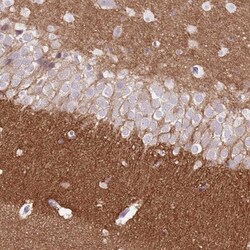 DPP6 Antibody, Novus Biologicals 0.1mL; Unlabeled:Antibodies, Polyclonal